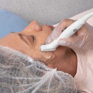 Ultrassonografia Dermatológica